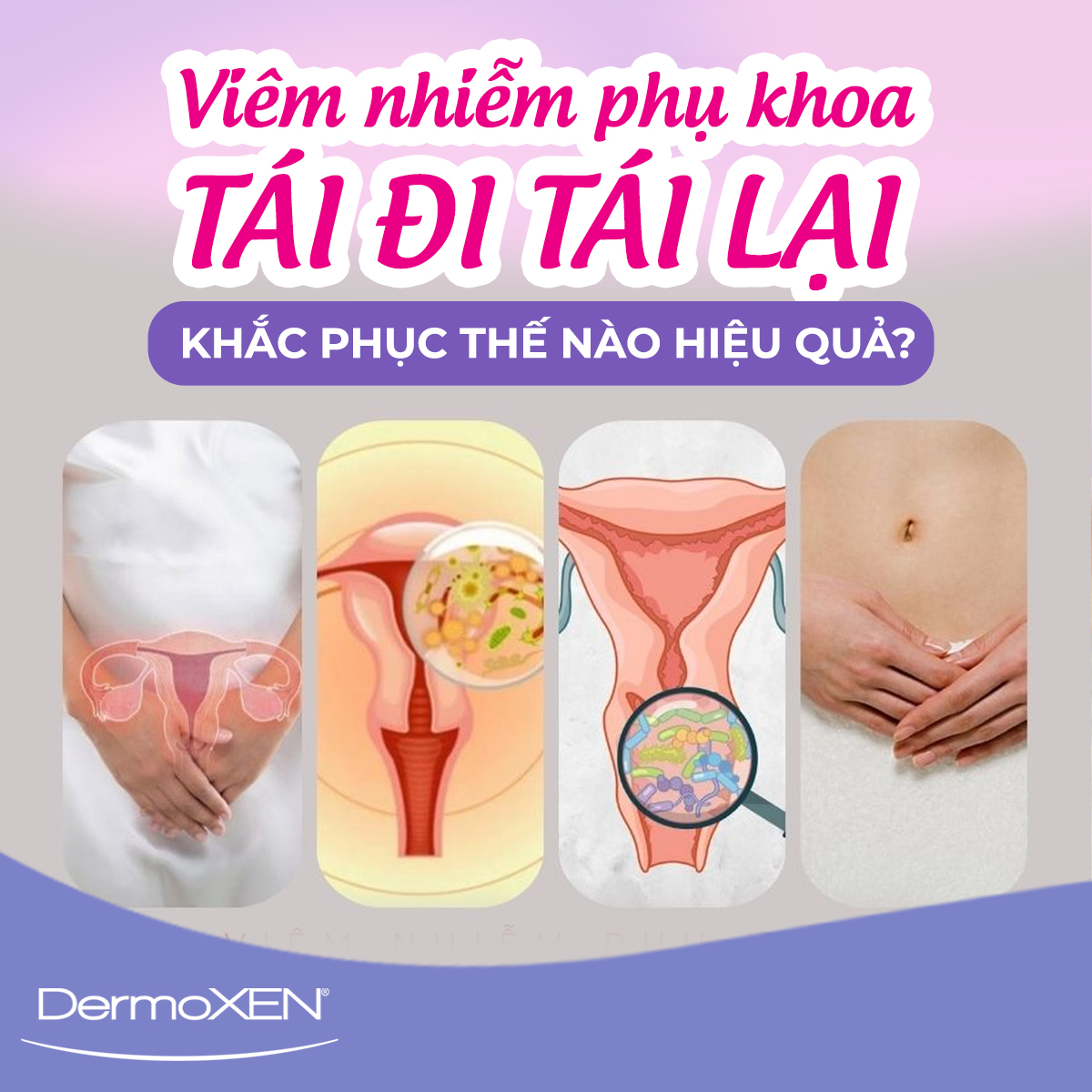 VIÊM CỔ TỬ CUNG MÃN TÍNH GÂY RA CÁC TỔN THƯƠNG SÂU VÀ ẢNH HƯỞNG ĐẾN KHẢ NĂNG MANG THAI